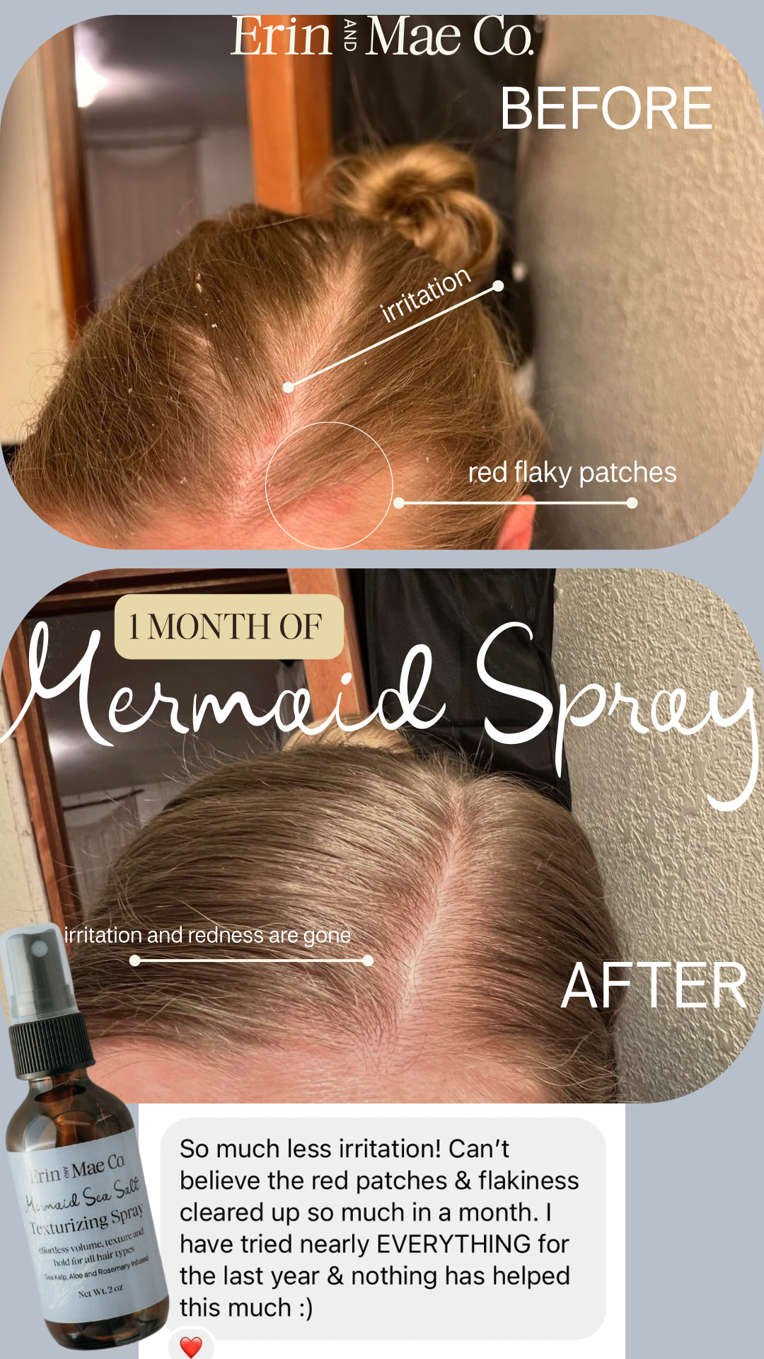 Mermaid Texturizing Sea Salt Spray: Boost Growth, Texture and Softness Naturally