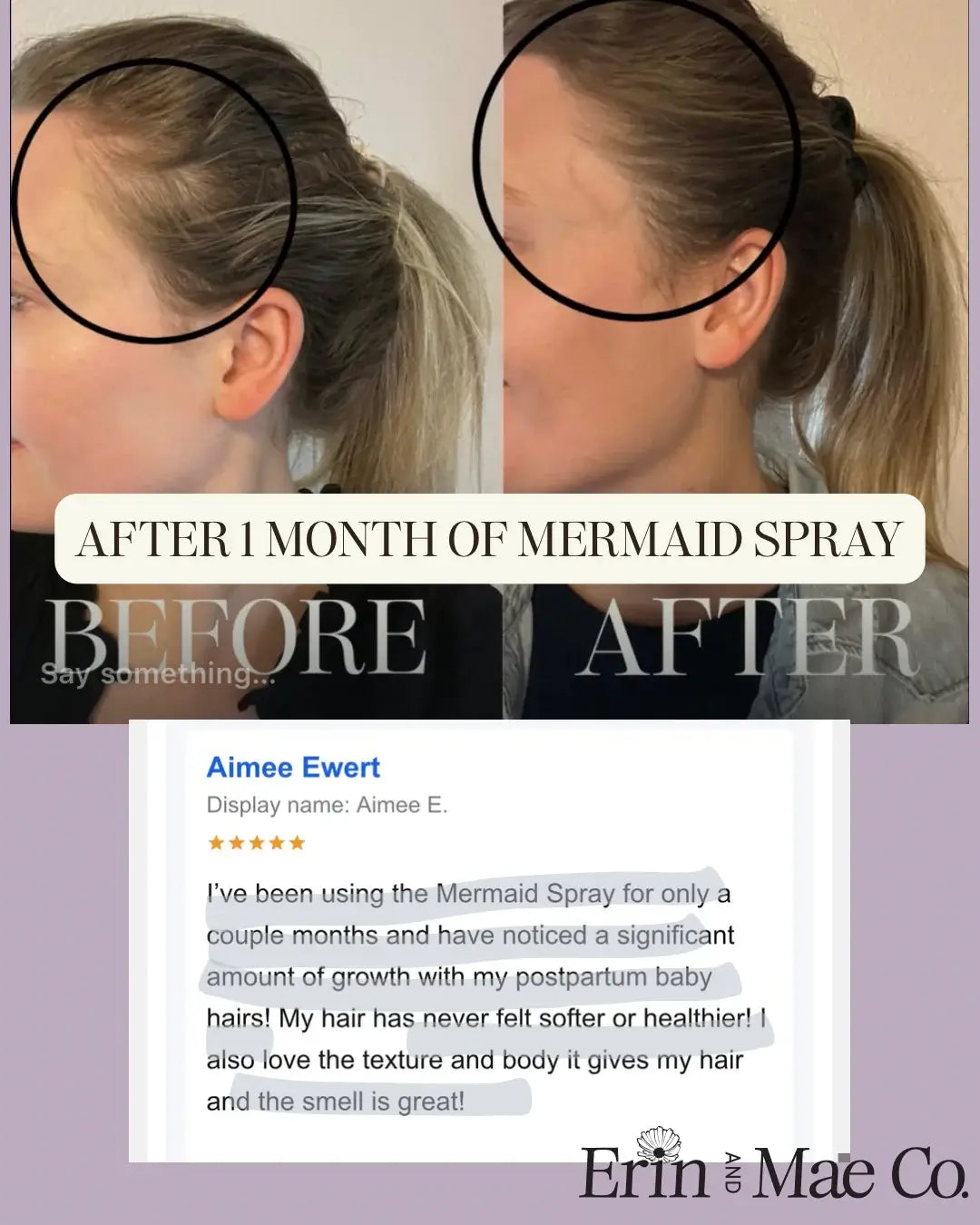 Soothing Scalp + Hair Growth Bundle